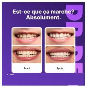 Bandes Blanchiment Dentaire (box2)